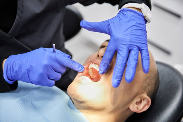 Best Knocked-Out Tooth Emergency  in Marina Del Rey, CA